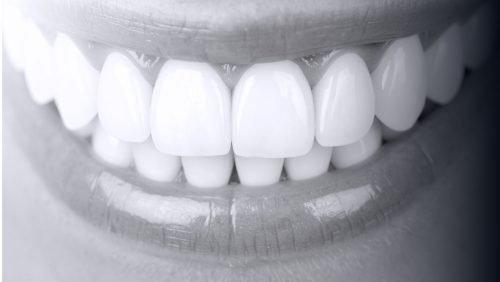 illustration de rehabilitation globale dentaire