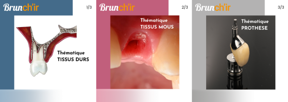 brunchir-2